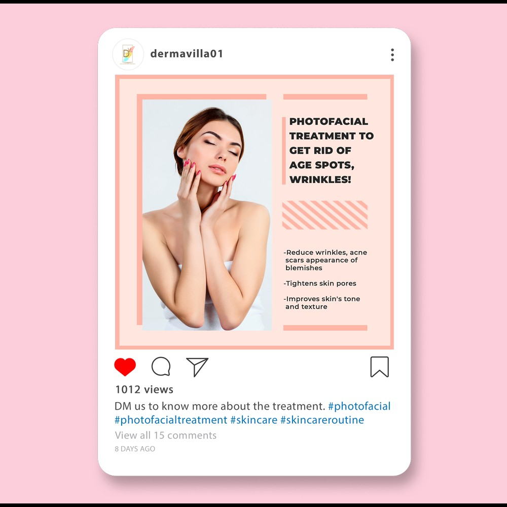 digital-marketing-01