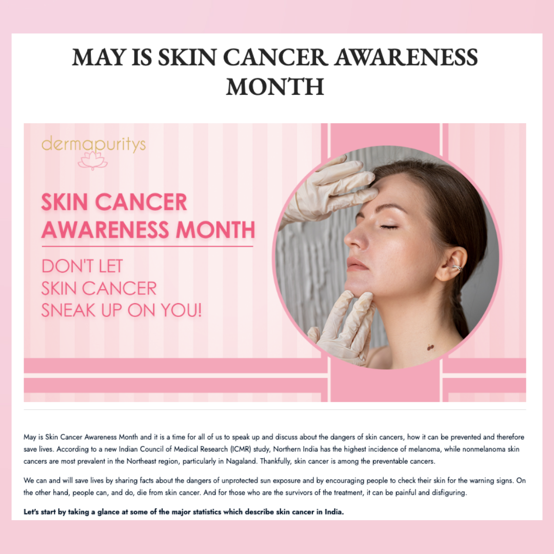 search-optimization-image-01